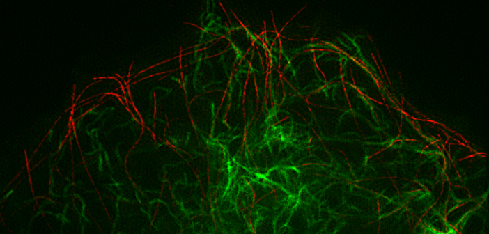 Vimentin intermediate filaments (green), responsible for the mechanical support of cells, are organized by their transport along microtubules (red). Northwestern Medicine scientists used images like this, acquired using super-resolution microscopy, to discover and measure vimentin filament transport.