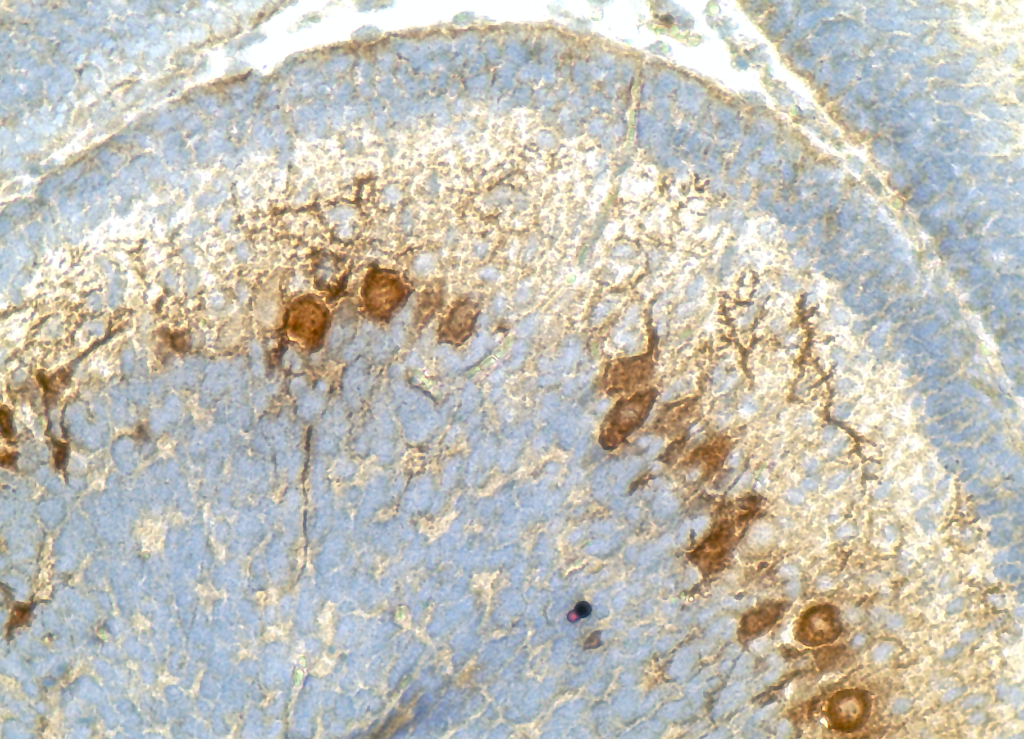 This image shows infected neural cells (brown) in the lab’s model of herpes simplex virus encephalitis.