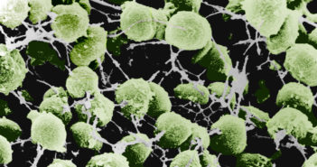 Scientists ID Substance Aiding Transmission of Gonorrhea