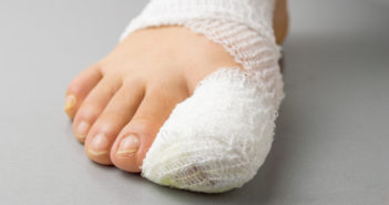 Accelerating Diabetic Wound Healing