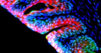 Tissue Regeneration Using Anti-inflammatory Nanomolecules