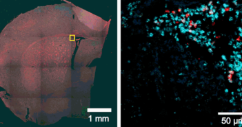 Calcium Channel Discovery Unlocks Brain Therapy Options calcium channels in brain section