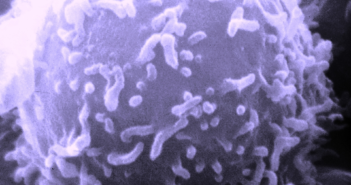 Protecting Women From Multiple Sclerosis
lymphocyte