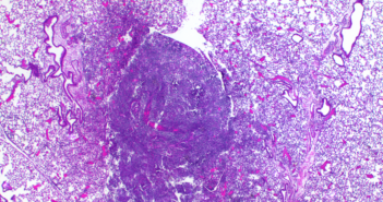 Uncovering the Origin and Evolution of Pneumonic Plague Pestoides