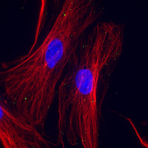 A new study shows how herpes simplex virus particles (green) latch on to microtubules (red) to travel to the nucleus (blue) of a host cell to replicate. <prop id="look-up-table-custom-values" type="int-array" value="0,0,0,0,0,0,0,0,0,0,0,0,0,0,0,0,0,0,0,0,0,0,0,0,0,0,0,0,0,0,0,0,0,0,0,0,0,0,0,0,0,0,0,0,0,0,0,0,0,0,0,0,0,0,0,0,0,0,0,0,0,0,0,0,0,0,0,0,0,0,0,0,0,0,0,0,0,0,0,0,0,0,0,0,0,0,0,0,0,0,0,0,0,0,0,0,0,0,0,0,0,0,0,0,0,0,0,0,0,0,0,0,0,0,0,0,0,0,0,0,0,0,0,0,0,0,0,0,0,0,0,0,0,0,0,0,0,0,0,0,0,0,0,0,0,0,0,0,0,0,0,0,0,0,0,0,0,0,0,0,0,0,0,0,0,0,0,0,0,0,0,0,0,0,0,0,0,0,0,0,0,0,0,0,0,0,0,0,0,0
