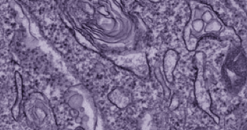 Investigating How Cholera Bacteria Toxins Inhibit Autophagy autophagy Satchell copy