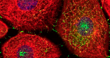2015 in Scientific Imagery A mutation in desmoplakin (green) delays assembly of the intermediate filament cytoskeleton (red) at cell-cell junctions.