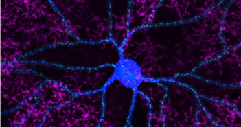 Mechanism Behind Insensitivity to Pain Discovered There are 30 to 40 different output neurons in the retina called ganglion cells that stream information through the optic nerve to the brain, but many of them have not yet been functionally characterized.