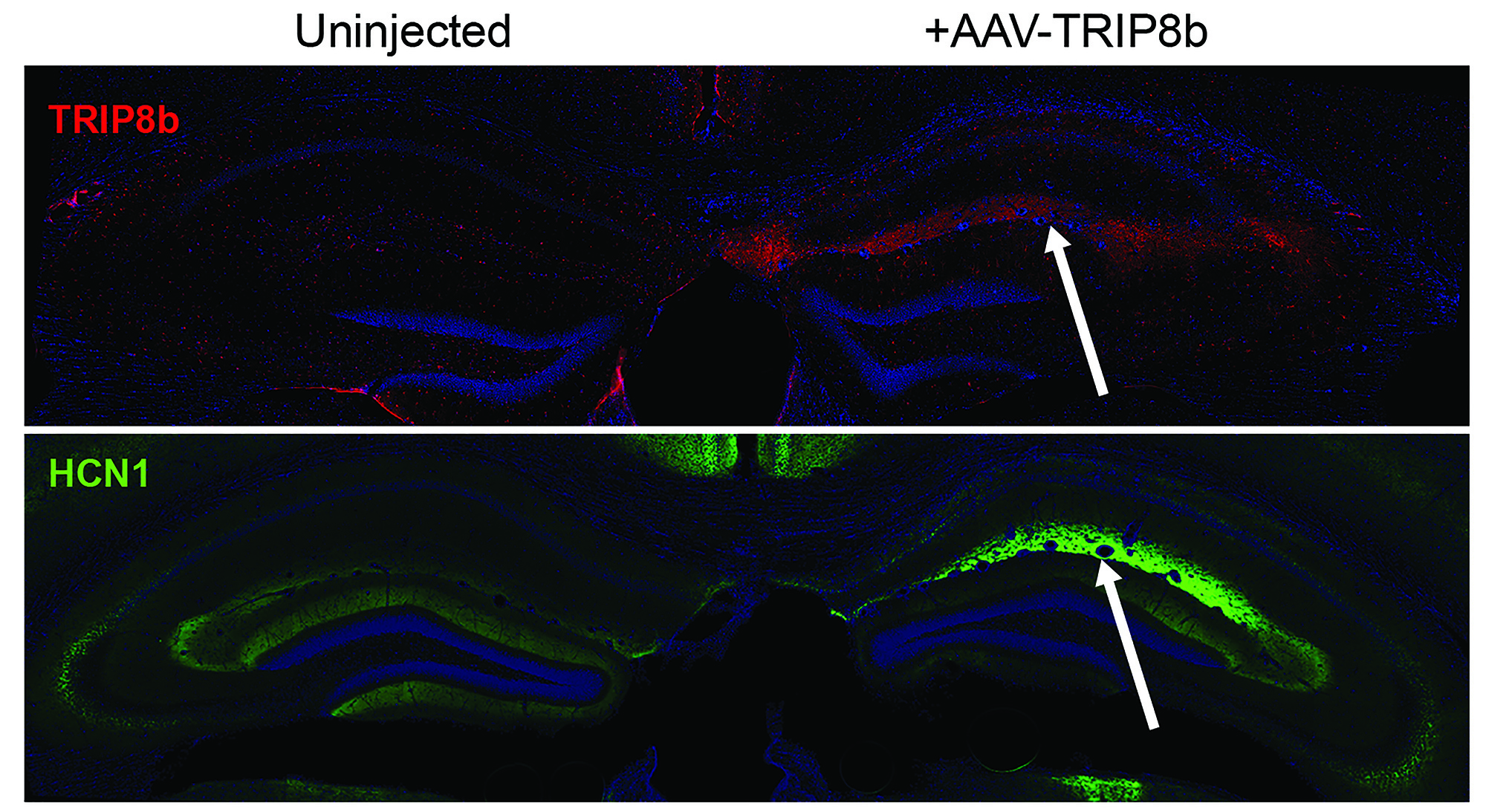 Microscopic images of brain sections from a mouse injected on one side with a virus engineered to increase the expression of HCN channel proteins (TRIP8b and HCN1). The fluorescent signal corresponding to HCN channel proteins is much higher in the injected hippocampus (arrows) compared to the uninjected side. 