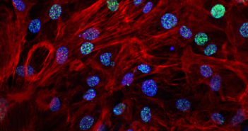 Scientists Reprogram Stem Cells to Regenerate Muscle in Muscular Dystrophy stem_cells_700