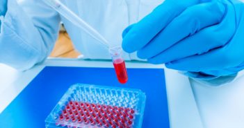 RNA Test Helps Identify Bacterial Infections in Infants scientist woman in genetic laboratory
