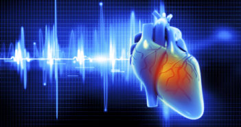 Short Episodes of Atrial Fibrillation Don’t Increase Stroke Risk Digital illustration of Human heart