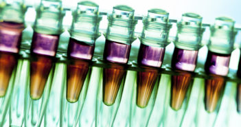 Laboratory research of cancer diseases, rack with RNA samples