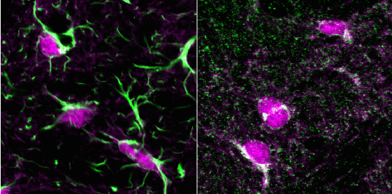Savio Chan, PhD, assistant professor of Physiology, and his team showed that astrocytes (pictured here) act as a brake on the motor suppression striatal pathway. 