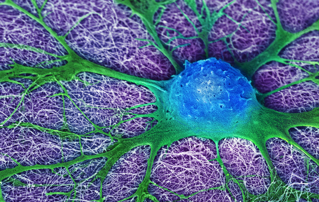image-17-neural-cell-looking-for-friends-by-mark-mcclendon-5th-2016crop