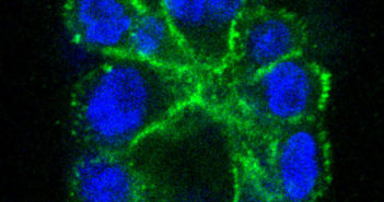 Insights Into Enzyme Targets Could Lead to New Cancer Therapies kiyokawafeaturedimage