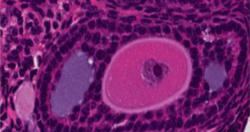 Examining Use of Small-molecule Inhibitors in Preserving Fertility This photo of antral follicles is a way to measure ovarian reserve.