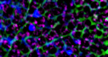Insights Into the Essential Building Blocks of the Nucleus Using cryo-electron tomography and super resolution light microscopy, scientists were able to see, for the first time more detailed structures of nuclear lamins. This high magnification super-resolution image of a region of the nuclear surface shows a meshwork of lamin fibers (green) and chromatin (DNA) seen in blue and magenta.