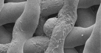 3-D Printed Ovaries Produce Healthy Offspring 7-immature-mouse-egg-after-6-days-in-bioprosthetic-ovary
