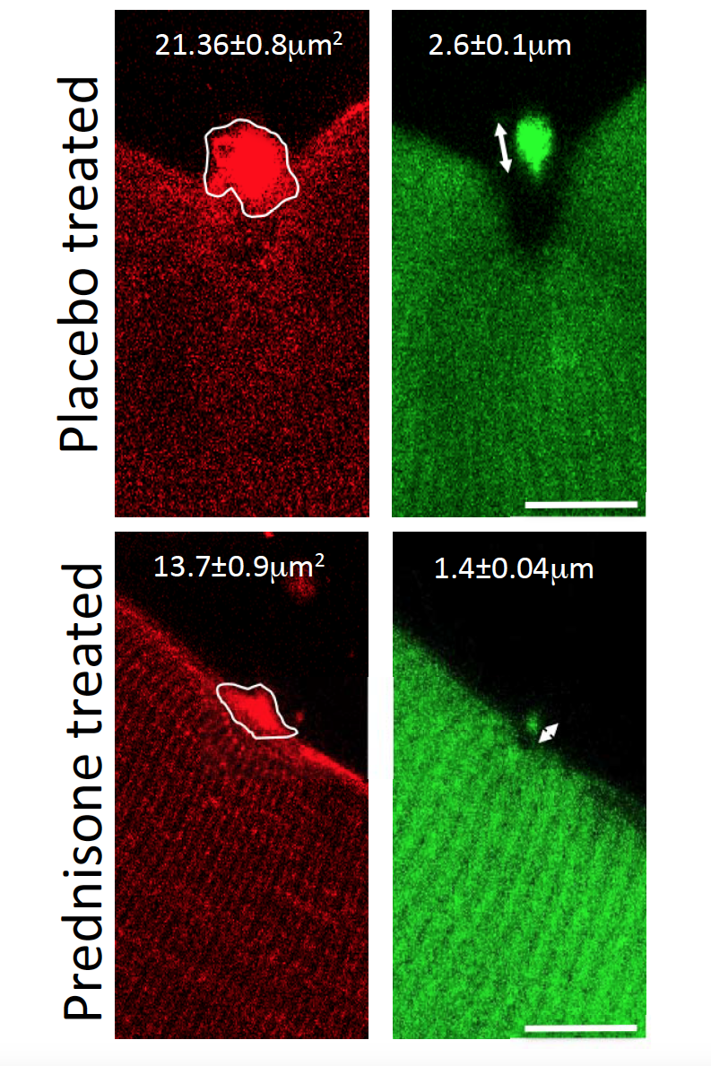 Weekly Steroids Strengthen And Repair Muscles News Center