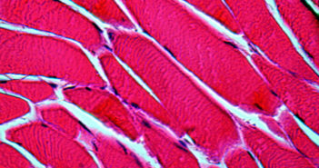 Weekly Steroids Strengthen and Repair Muscles mikroskopic picture of a professional histologic preparation of muscle cells of striated skeleton muscles at 1000times magnification (HE-stained)