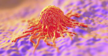 Glioblastoma tumor-1024x682crop