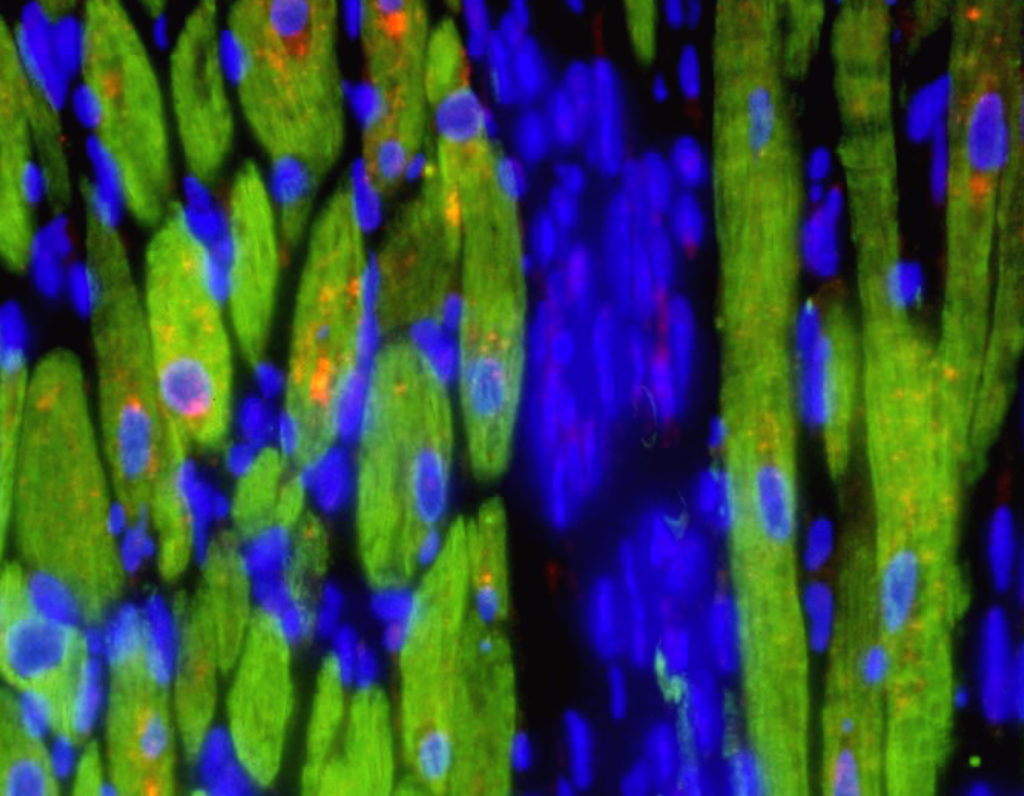 Localization of pro-fibrotic hormones in heart muscle cells (green), which synthesize and release transforming growth factor-beta (red) following cardiac injury. Nuclei are shown in blue.