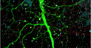 Active Non-Coding DNA May Help Pinpoint Genetic Risk for Psychiatric Disorders induced-neuronpenzes