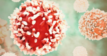 Trial Finds No Survival Benefit to Aggressive Breast Cancer Procedure Cancer Cell