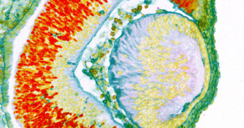 Exploring the Genetics of Glaucoma and Retinal Development 21-6-jpg