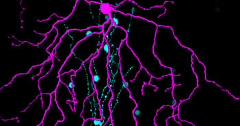 New Insights Into How the Retina Processes Orientation couplednetworkfeatured