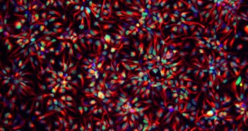 DNA Methylation Plays Key Role in Stem Cell Differentiation fsm-pic