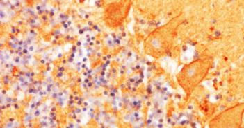 Adult-Onset Neurodegeneration Has Roots in Early Development normal_main