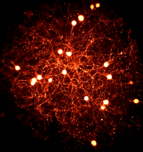 In vitro cultured nociceptive neurons genetically labeled in red and ready for analysis of their intracellular calcium concentration using Fura-2 in vitro calcium imaging.