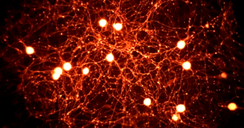 Molecule May Be Key to Pain Relief in Diabetic Neuropathy