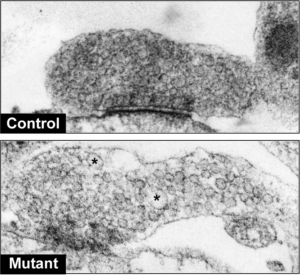 control-vs-lrrk2-patient-synapses
