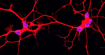 New Technique Helps Uncover Changes in ALS Neurons als_neurons