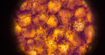 Long Non-Coding RNA May Play Role in Fat Metabolism