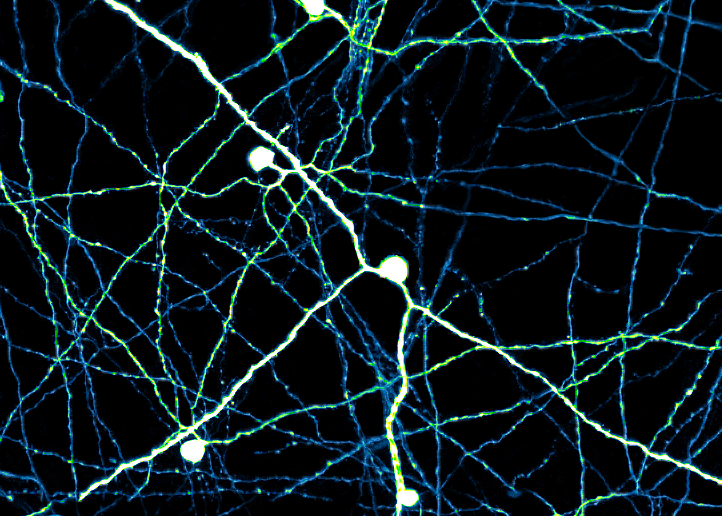 origin of neuromodulator in the retina pinpointed