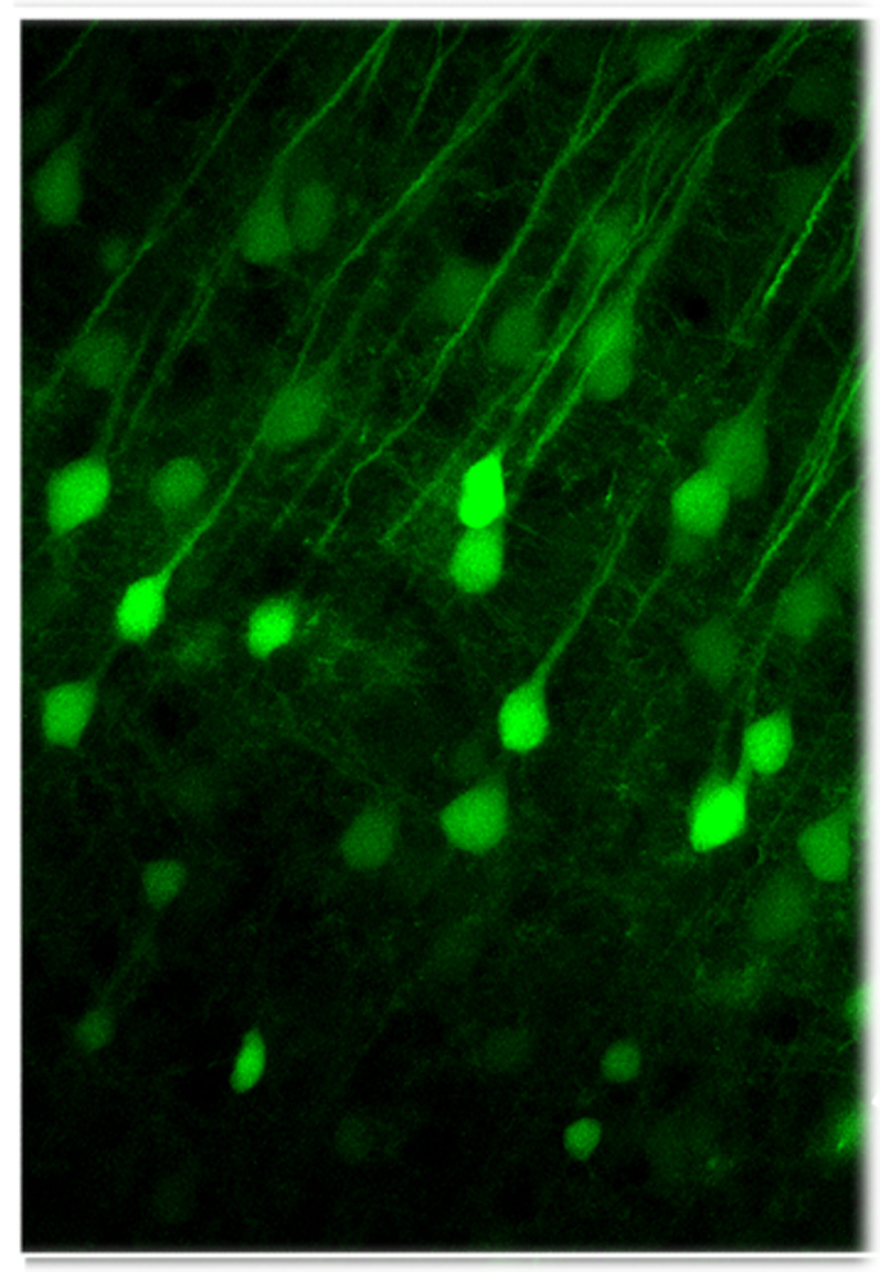 Neon Exposes Hidden ALS Cells, Helps Scientists Study Why They Die