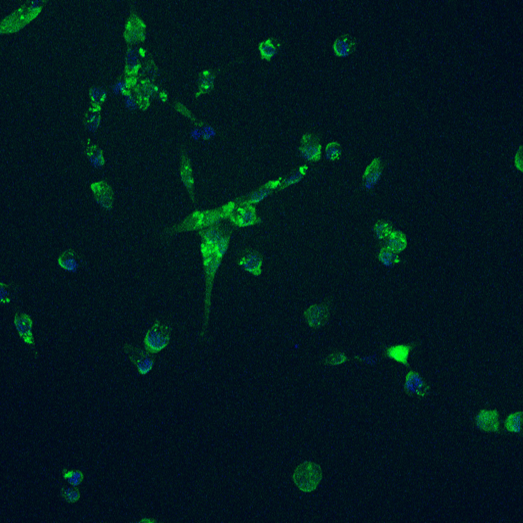 Nanodiamonds Used to Improve Bone Growth