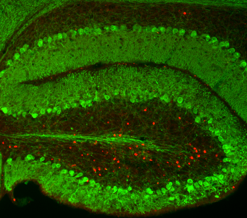 Scientist Uncovers Selective Cell Death in Ataxia