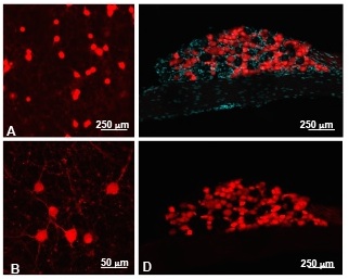 The Role of Signaling Pathways in Painful Diabetic Neuropathy