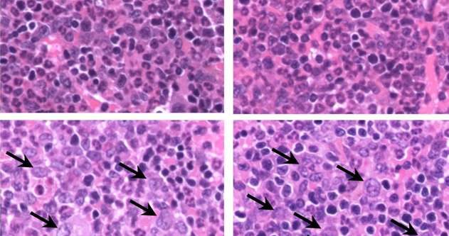 Proteins Involved in Blood and Bone Marrow Disease