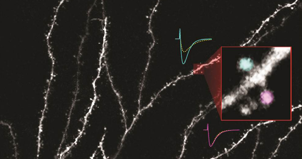 New Target for Huntington’s Disease Therapy