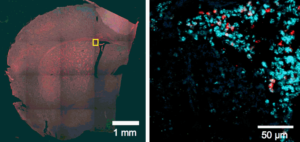 calcium channels in brain section