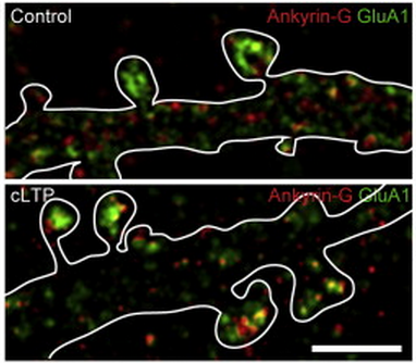 Bipolar Disorder Discovery at the Nano Level