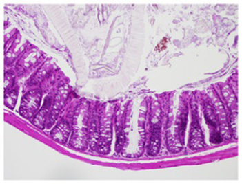 Regulation of Immune Response in the Gut