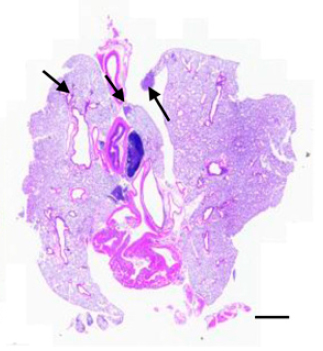 Stopping Tumor Growth During Hypoxia