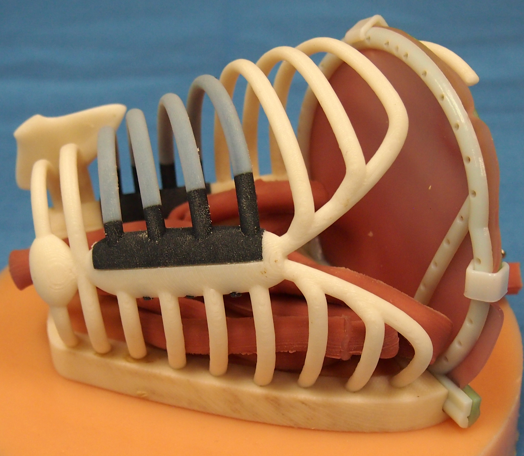 3-D Printed Models Provide Lifelike Simulations for Training Pediatric Surgeons